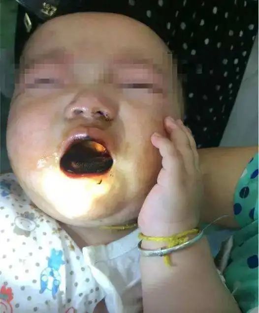 寒暑假溺水烧烫伤等意外事故高发深圳一男孩误食药品中毒