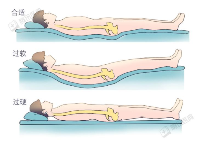 腰椎手术后正确睡姿图图片
