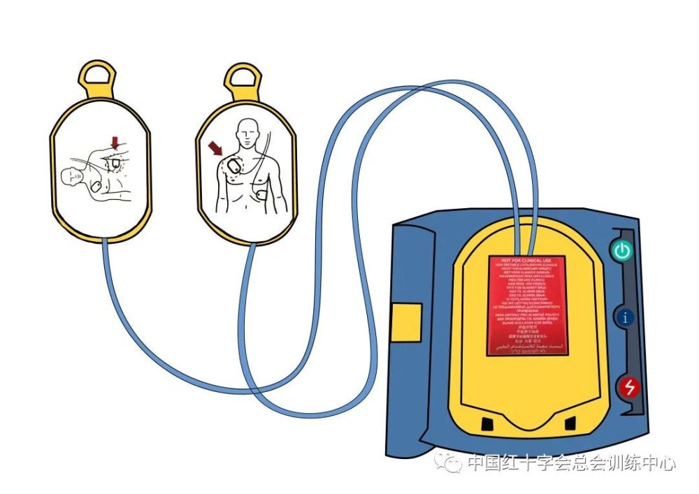 救在身边如何使用aed