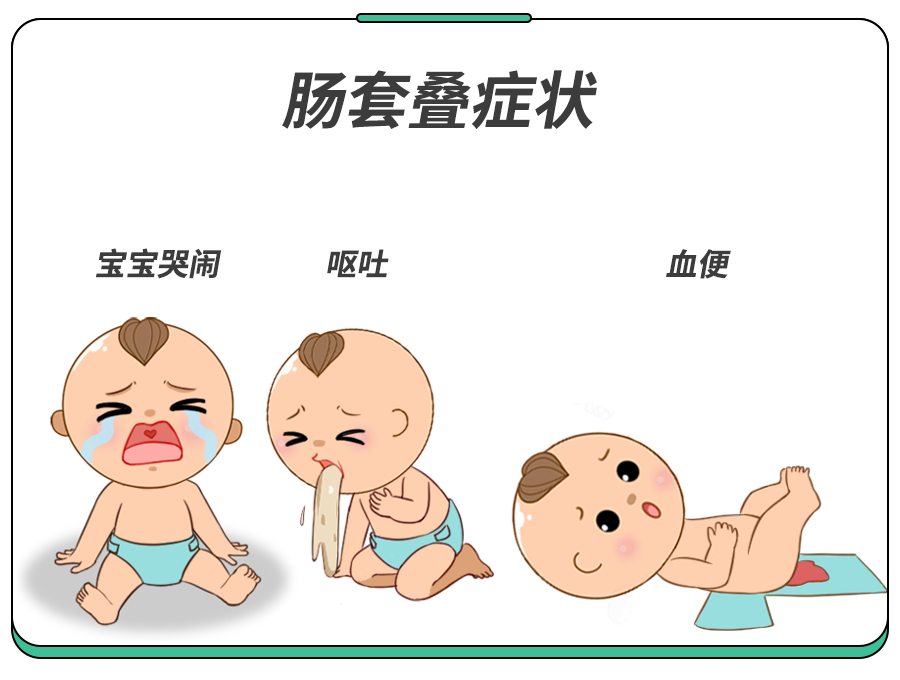 肠套叠通常发生于6~36月龄,约60%的肠套叠患儿不到1岁,80%~90%不到2岁