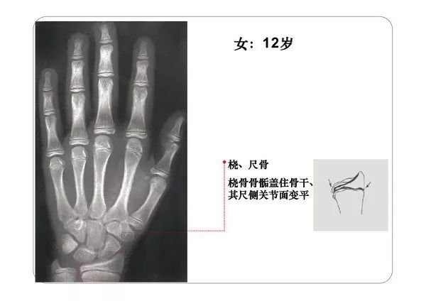 一些國外同仁的文獻:上肢(a)和下肢(b)的主要骨的二次(骨骺和骨骺)