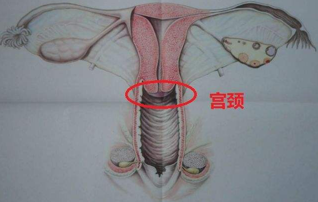 子宫内膜息肉和宫颈息肉哪个更严重要做手术吗