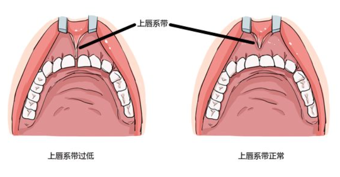 ③口腔兩邊有兩塊突出的肉叫什麼?