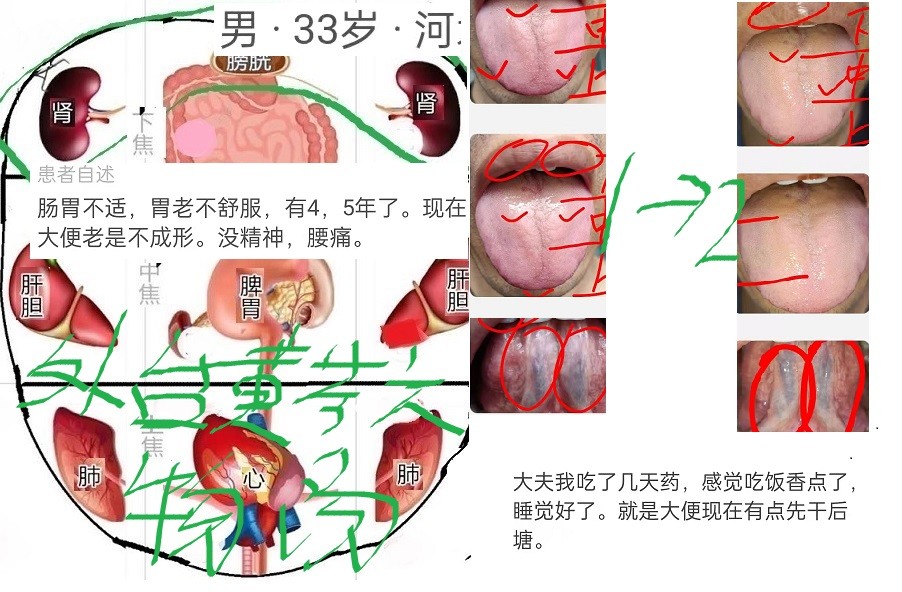 中醫師張躍舌診 圖片對比第一期9張_騰訊新聞