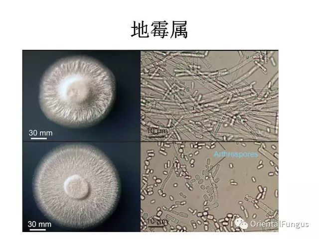 看几个例子(代表粉孢子的皮肤癣菌太常见,就不举例了)粉孢子:无性孢子