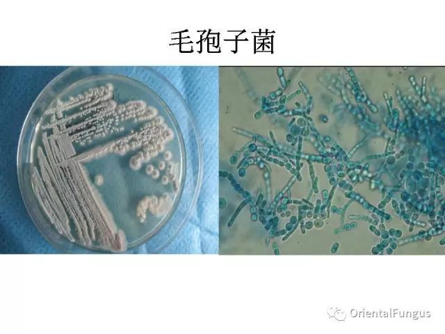 真菌孢子图谱合辑_腾讯新闻