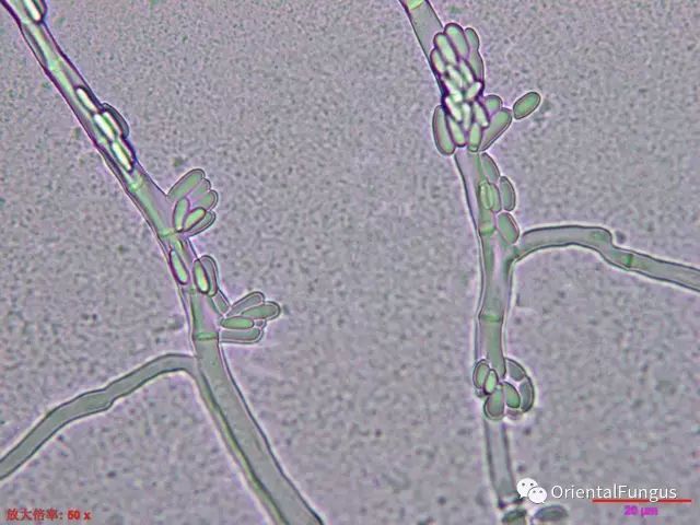 出芽短梗霉(年轻的菌落,孢子从关节处发生)看示意图:合轴产孢:围绕