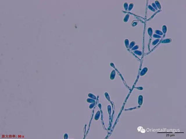 真菌孢子图谱合辑_腾讯新闻