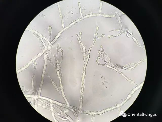 真菌孢子图谱合辑_腾讯新闻