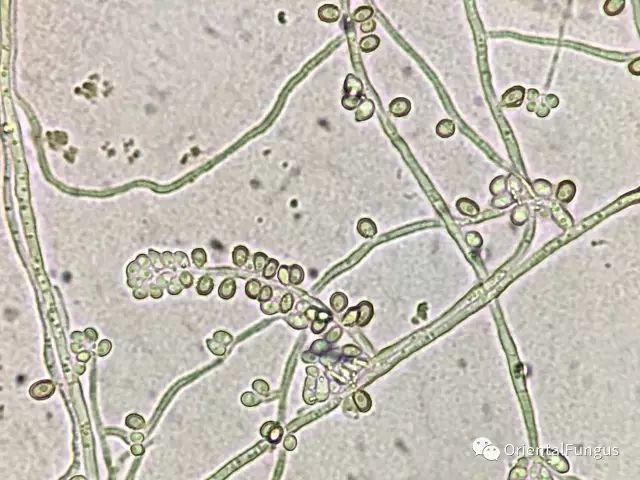 超全真菌孢子图谱合辑