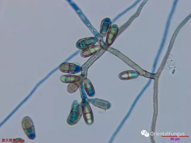 真菌孢子图谱合辑_腾讯新闻