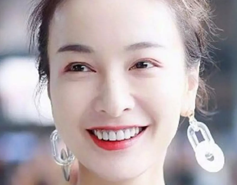 又有明星乱整牙了宋祖儿门牙变吴宣仪同款张嘴还能看到色差