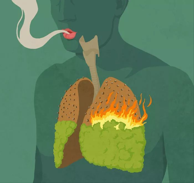 常吸烟的人一旦身体出现3黑3多表现要抓紧查查肺了