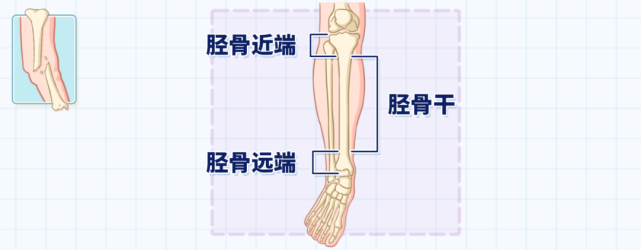 正常人腿骨架图片图片