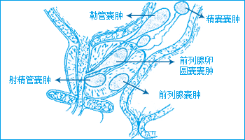 b超提示苗勒管囊肿这病严重吗