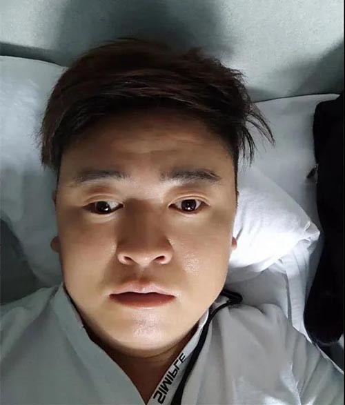 如果眼位斜了,并且3-5年就要做一次矫正,别说自己了,眼睛能经得起这么