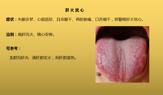 胆火 腾讯网