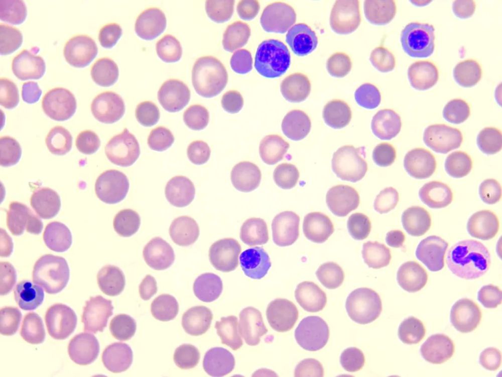淋巴细胞还是有核红细胞让我们来揭开这神秘的面纱