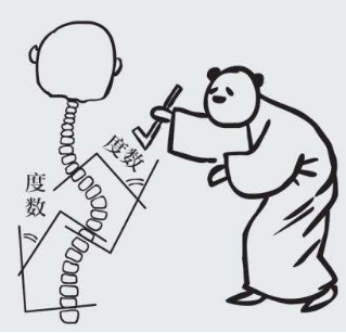 脊柱侧弯是指脊柱向侧方弯曲,可伴有椎体旋转,前凸或/和后凸改变的