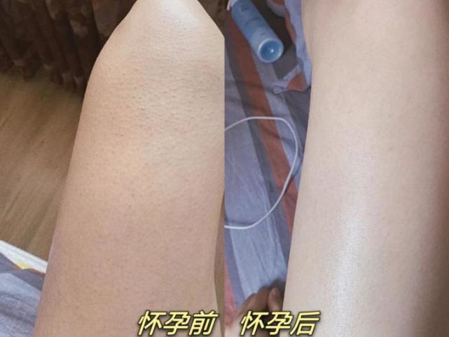 暗沉鸡皮肤怎么消灭(皮肤暗沉怎么才能知道)