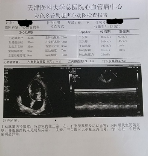 肌酸激酶(ck), 肌酸激酶同工酶(ck-mb)和肌钙蛋白i(tni) 均未见异常