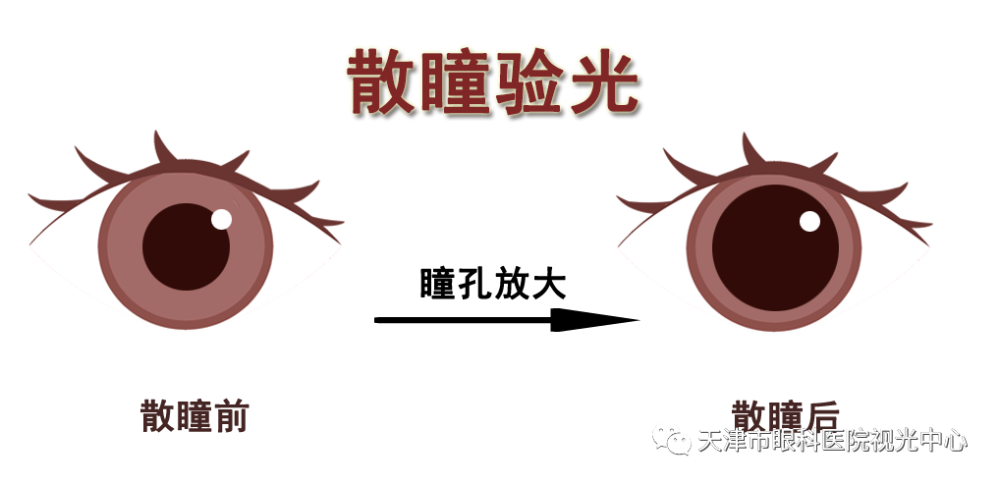 你问我答散瞳验光知多少