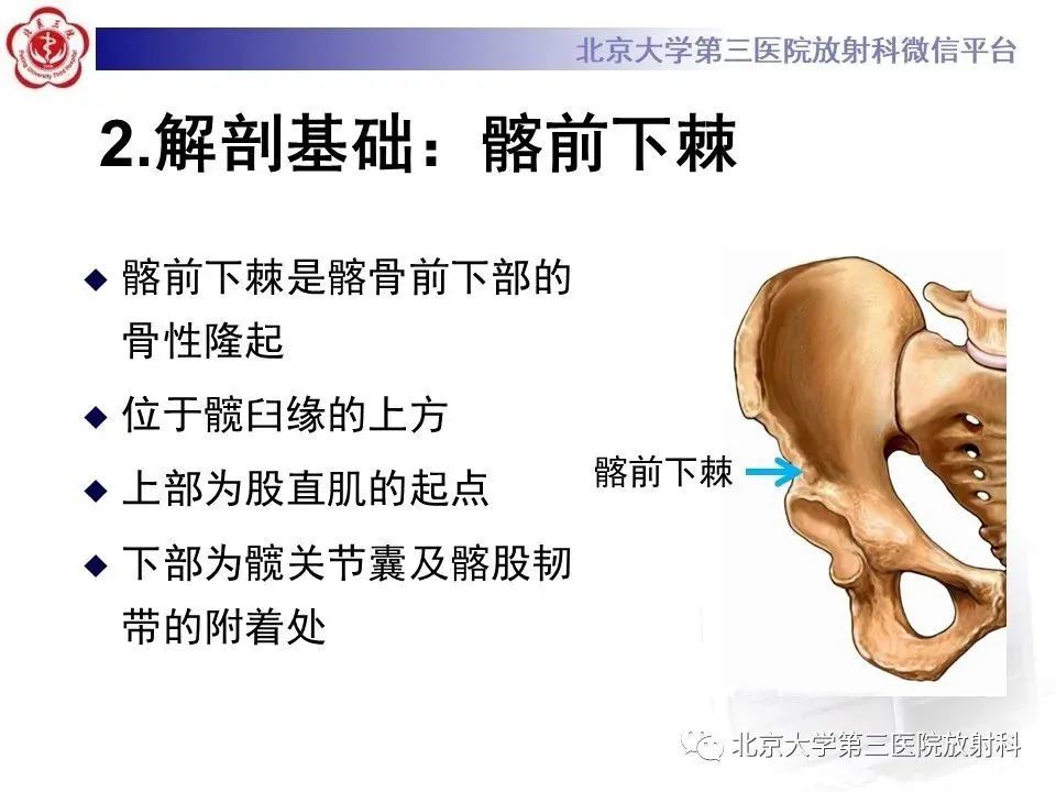 一文掌握髖關節髂前下棘撞擊