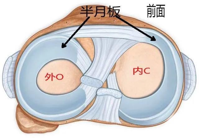 啥是半月板損傷後必須切除嗎