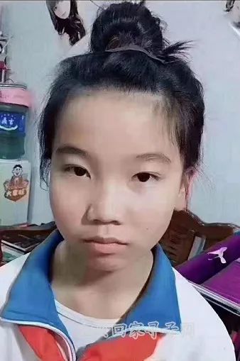 寻亲类别:家寻宝贝宝贝回家编号:440792姓    名:孙明双性    别:女