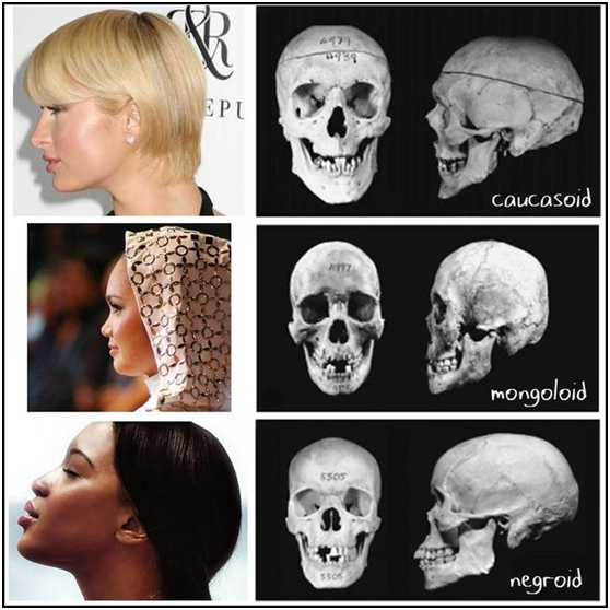 欧洲人的鼻子,眉弓会更加立体,亚洲人会稍微平缓一点,欧洲男性的头骨