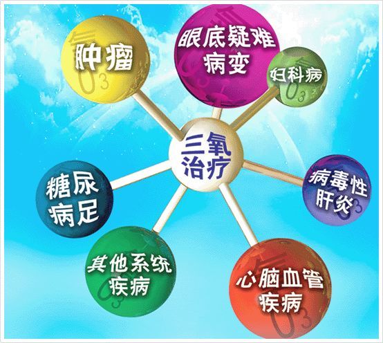 臭氧保健已是一种趋势臭氧的功效与作用要知道