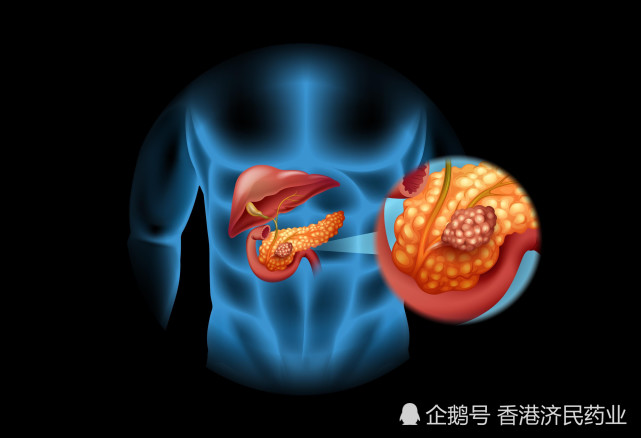 疾病控制率84lumakras對krasg12c突變晚期胰腺癌具有抗癌活性