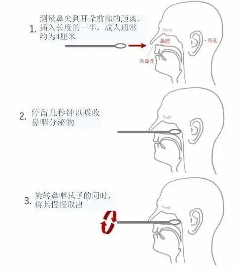 口咽,鼻咽拭子采集标准