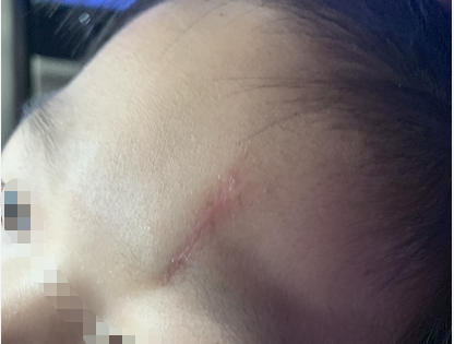 男孩在贵阳一商场里玩一头撞在这里被缝6针家长商场有一半责任