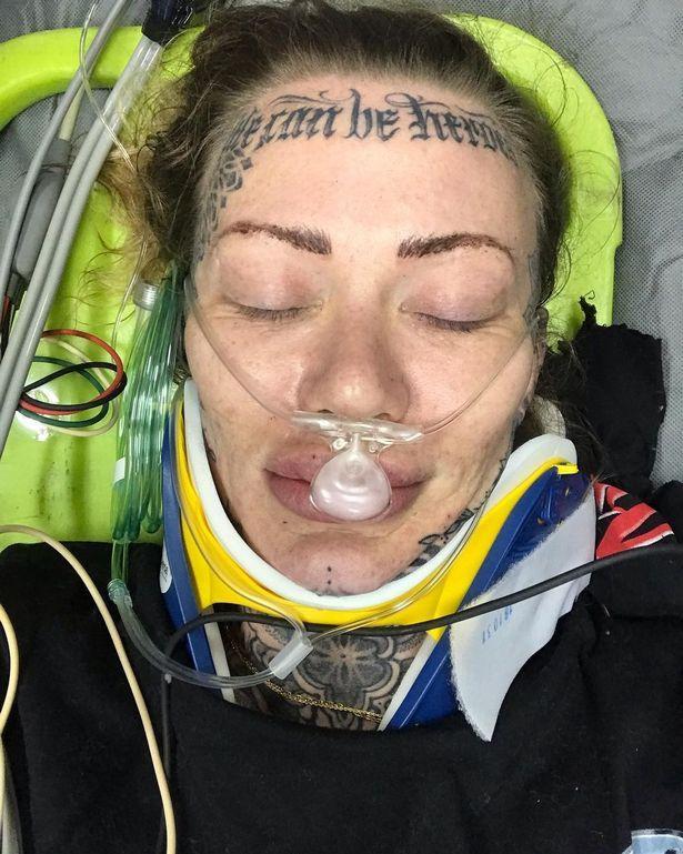 英国纹身最多的女人讲述严重车祸经历被抛到6米高空死里逃生