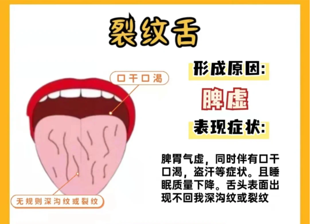 中医 从舌头看健康 舌象分析 常见的6种舌苔问题 和调理建议 腾讯新闻