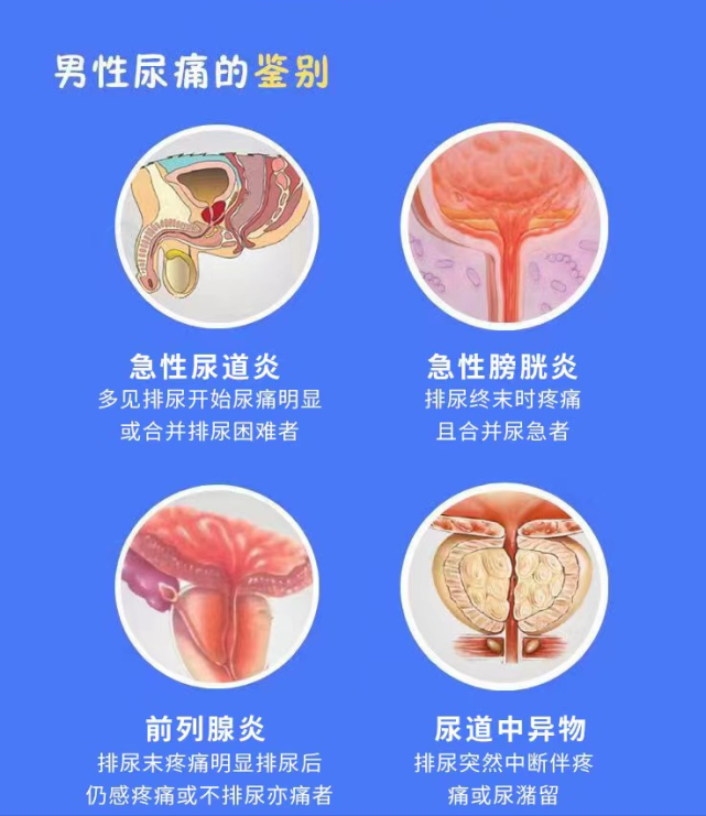 尿痛:指患者排尿时尿道或伴耻骨上区,会阴部位疼痛.