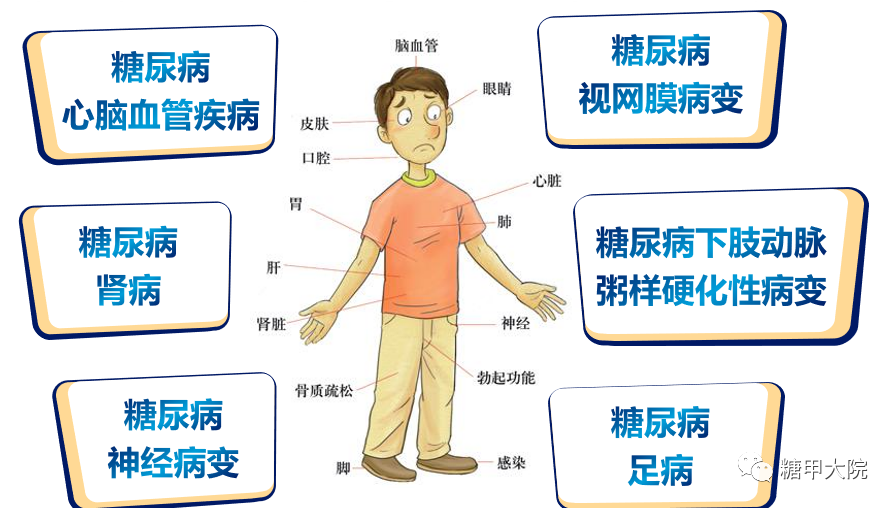 糖甲科普李医生得了糖尿病并发症还有救吗