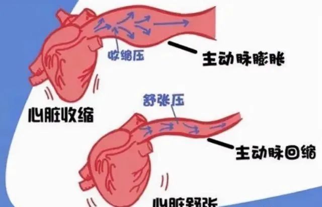 低压指的就是上文所说的收缩压,在心脏舒张,动脉血管弹性回缩的时候