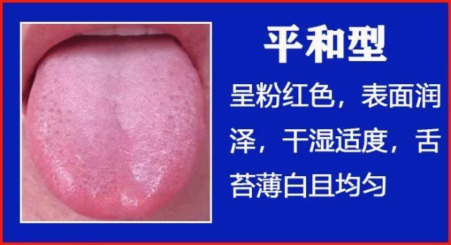 史上最全 高清舌诊图谱 看舌头知健康 人手一份 腾讯新闻