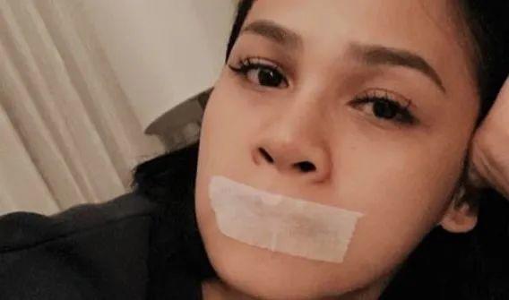 这位印尼女歌手睡前为什么要封住嘴巴?原因竟然是……
