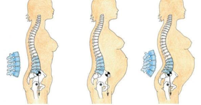 隨著胎兒長大,身體前側重量增加,會讓腰椎過度前凸,增加腰部負重;產後