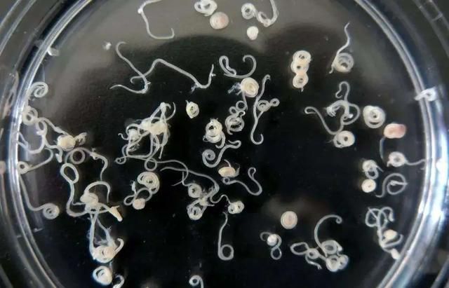 来自海产的寄生虫异尖线虫一旦患上无药可治