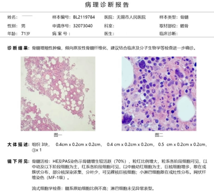 一例早期原發性骨髓纖維化的診斷歷程