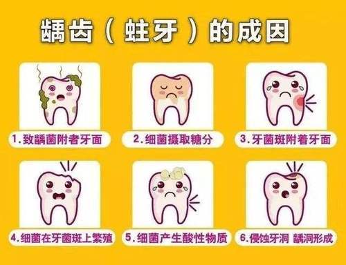 什么是龋齿