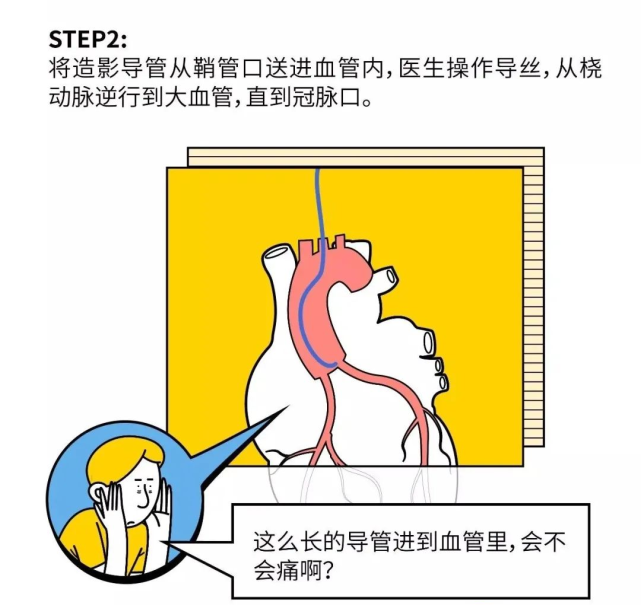 冠脉造影专家介绍