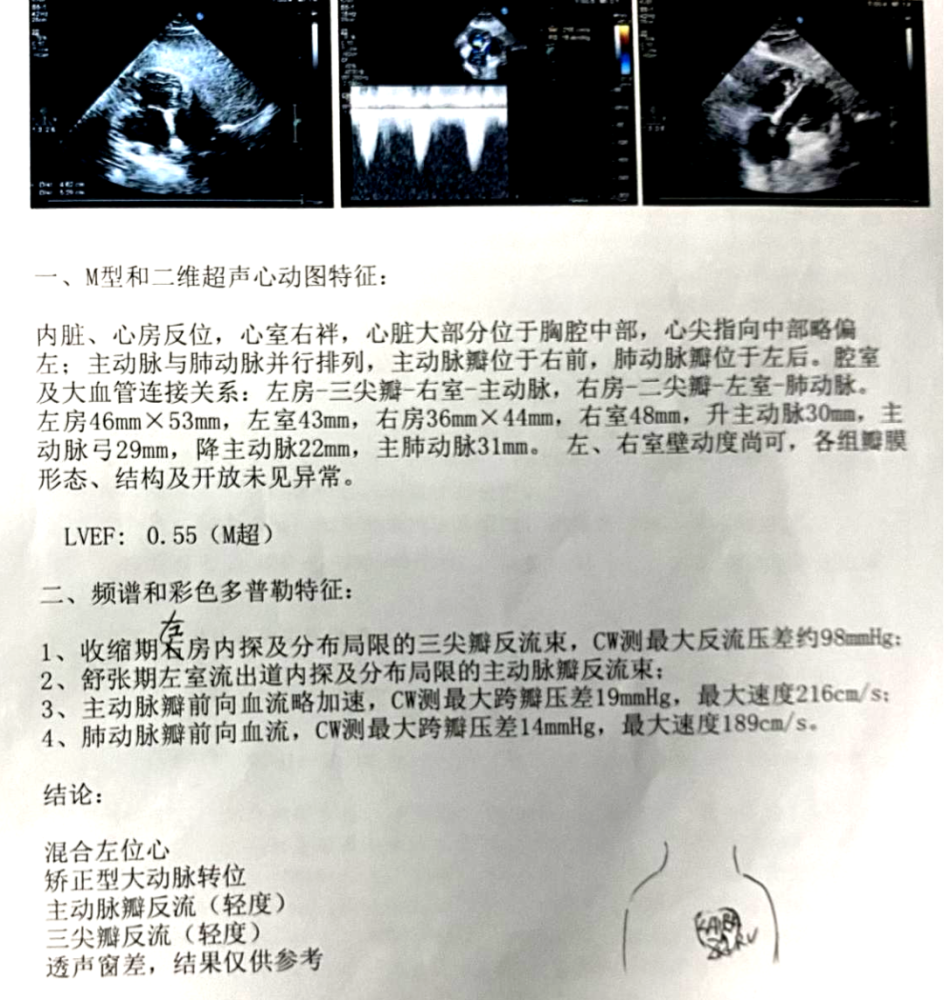 2. 超声心动图房室旁路(avrt)?不典型房室结双径路(avnrt)?
