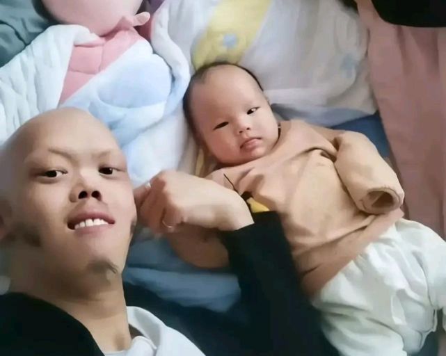 除了张伸之外,娱乐圈还有一位特型演员李平安,他是一位80后,曾经做过