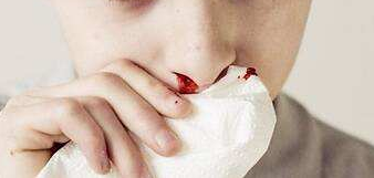 鼻炎到鼻咽癌身体会给你5次警告