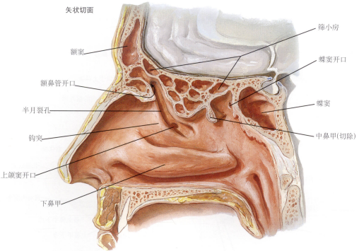 竇開口於中鼻道的半月裂孔鼻竇開口(上,中,下鼻甲及篩骨迷路內側壁切